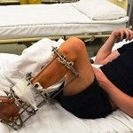 Українські лікарі-біотехнологи врятували від інвалідності бійця АТО
