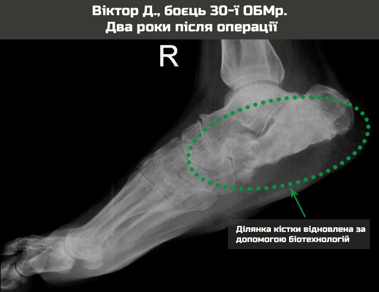 x-ray