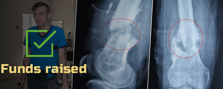 Vitaliy A, 26. Treatment is in progress