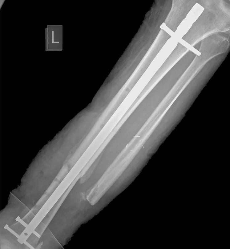 x-ray-bondarenko2