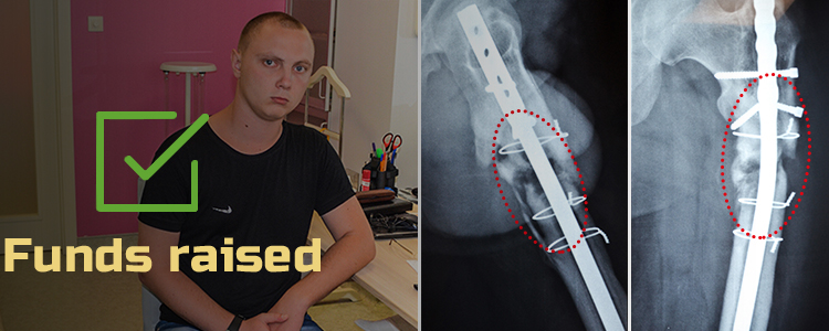Ihor, 24 year old. The treatment is in progress
