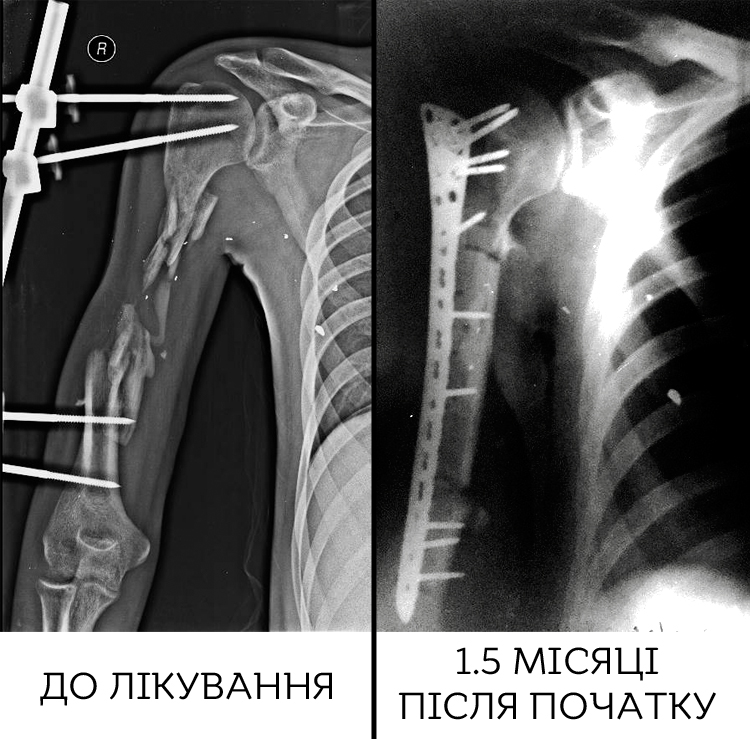 xray_1