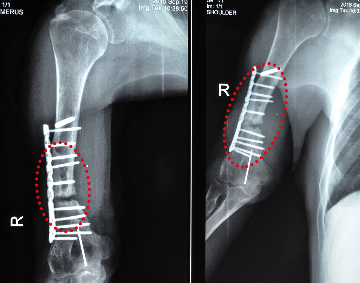 Stas-Myh_X-Ray