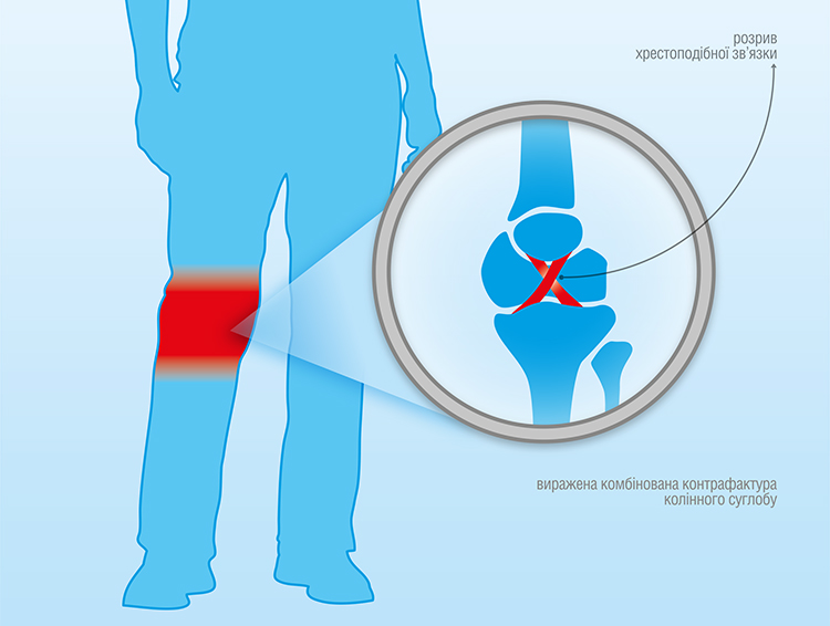 Mykyta Hl-injury graph