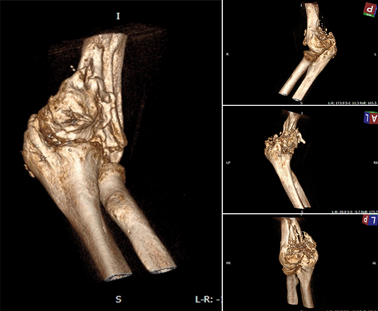 Dmytro trauma vis