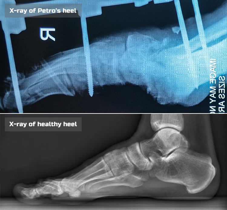 Petro O-X-ray comperison-eng