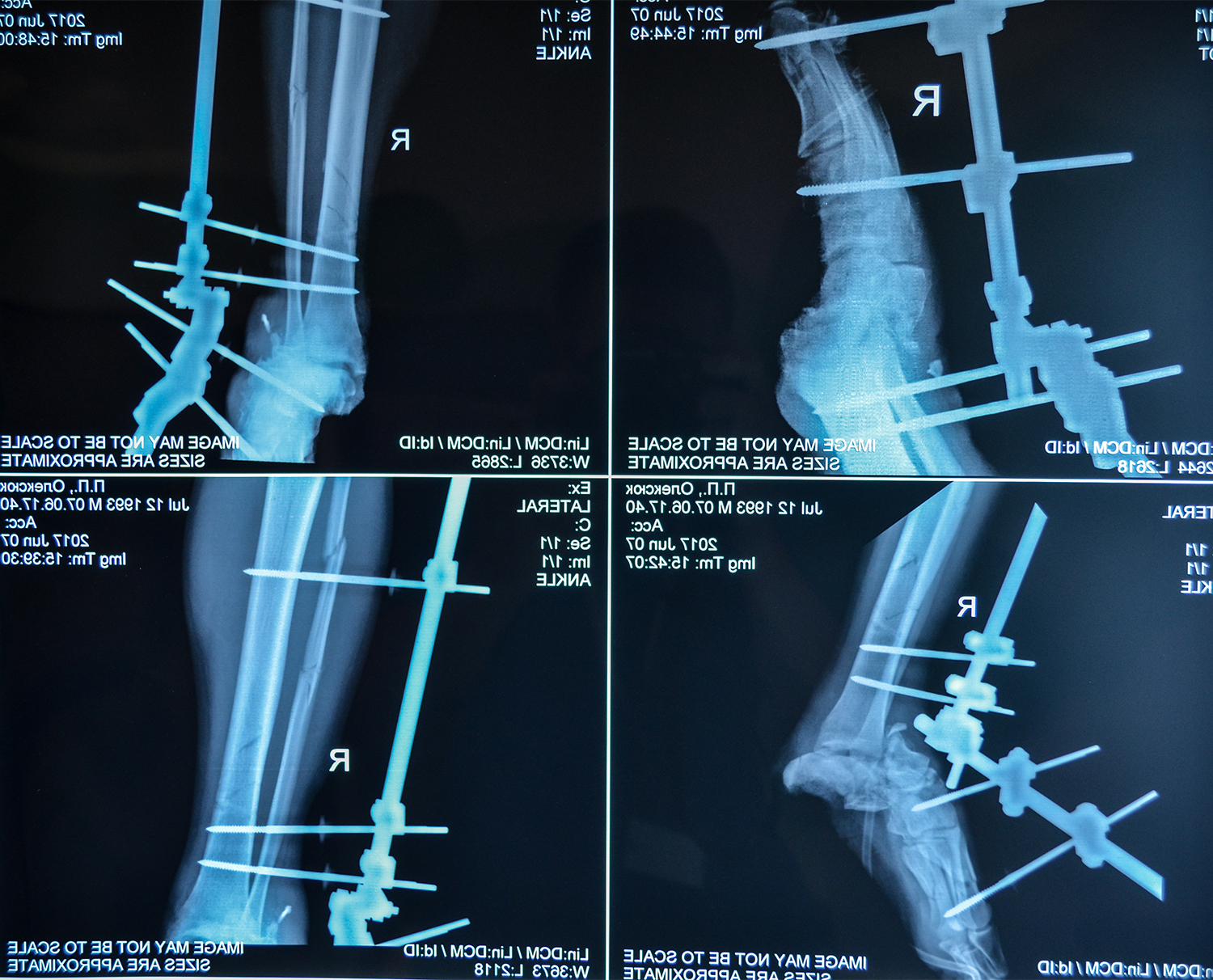 Petro O-X-ray