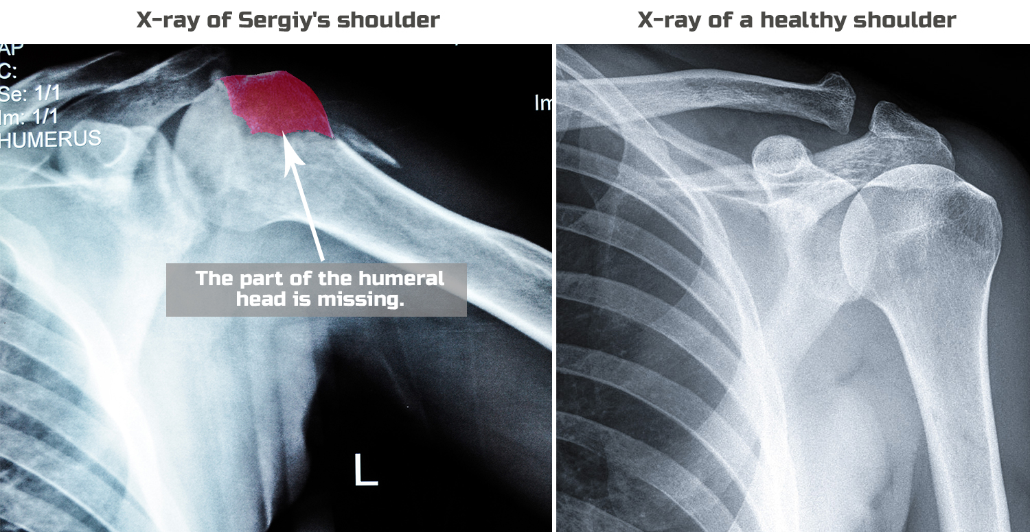 Sergiy_X-ray compare-engl