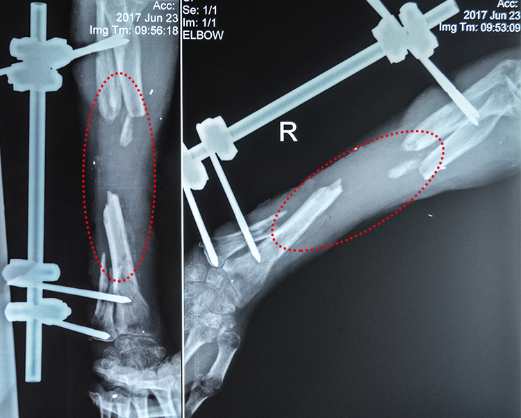 Volodymyr Sh_X-ray