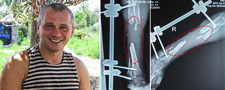 Volodymyr, 44. Cost of treatment 672 268 UAH