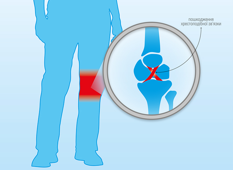 Volodymyr L-injury