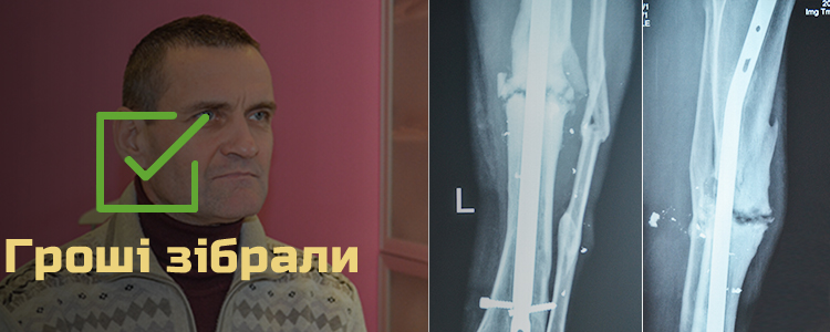 Валерій, 52 роки. Лікування триває