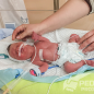 Brand new gas analyzer has already been saving lives of newborn Kyivans