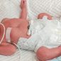 Let us give preterm newborns a chance to live